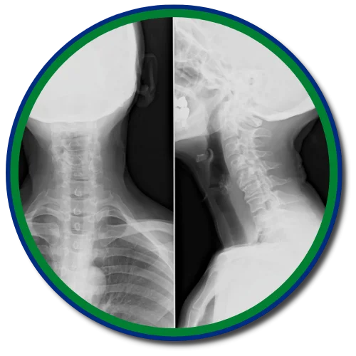 X-Rays